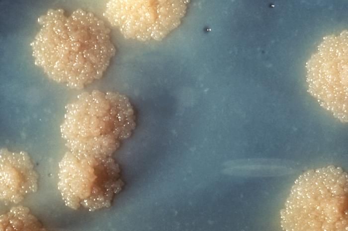 A close-up of a Mycobacterium tuberculosis culture.